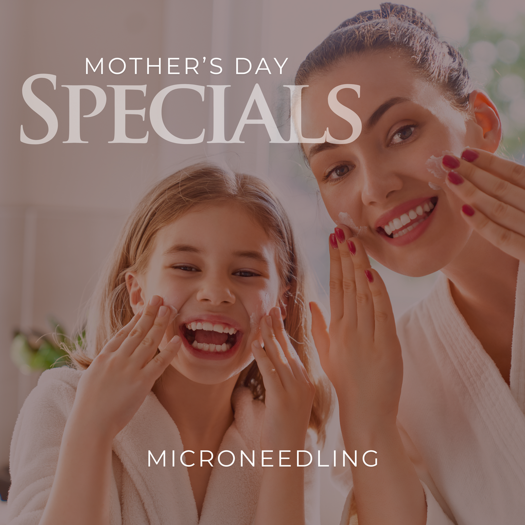 Microneedling Mother's Day Specials (Choose Package)