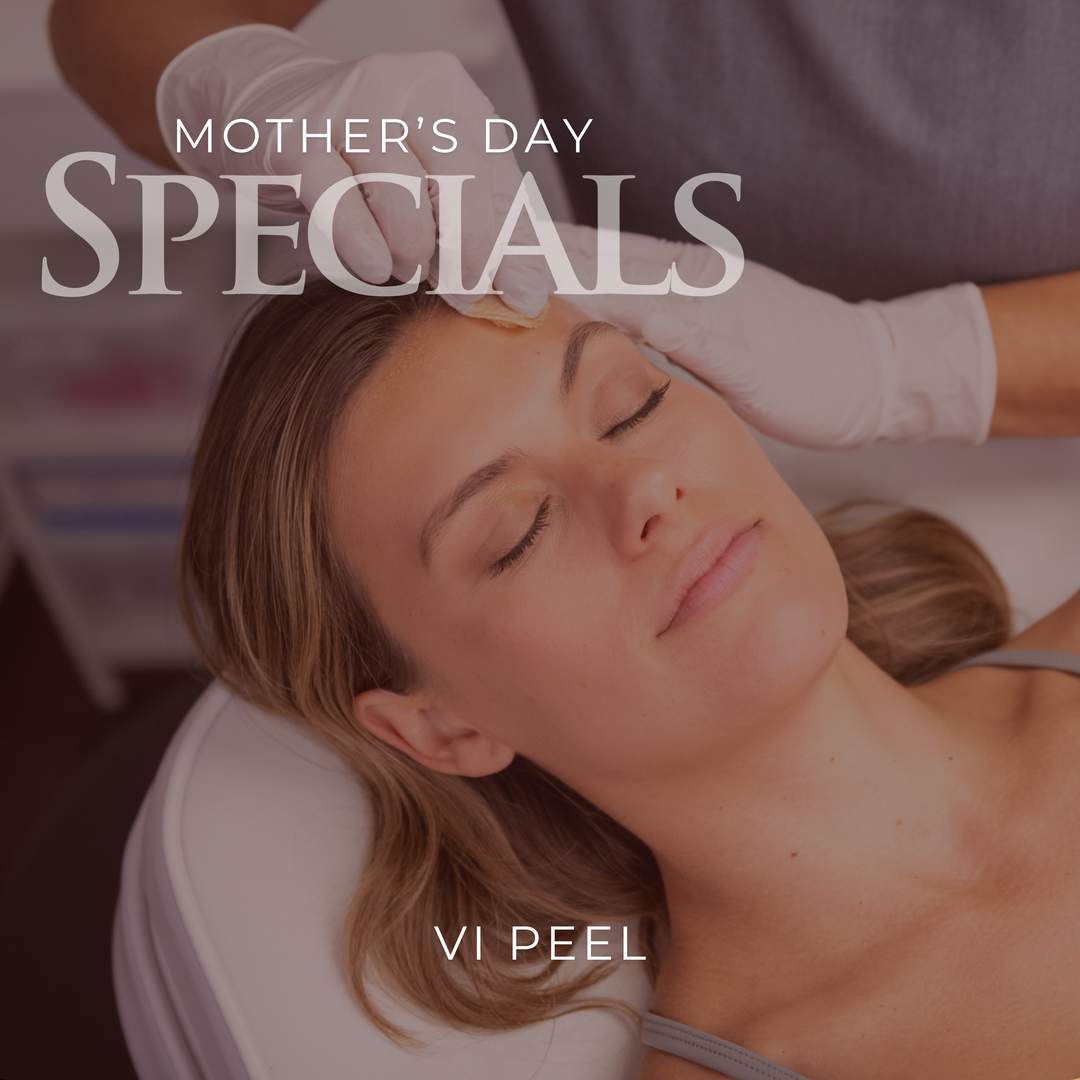 VI PEEL Mother's Day Specials (Choose Package)