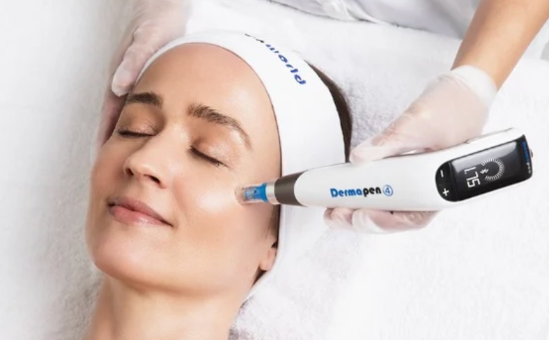 Microneedling 1 session